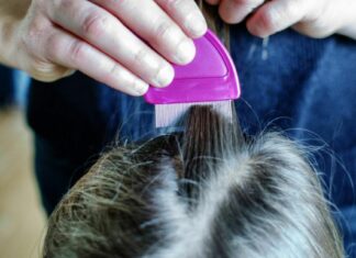 Poux vivants après le traitement : Causes, solutions et conseils pour s’en débarrasser définitivement