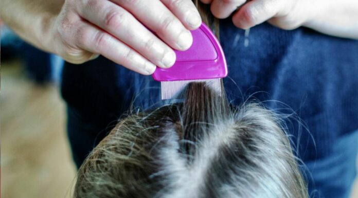 Poux vivants après le traitement : Causes, solutions et conseils pour s’en débarrasser définitivement