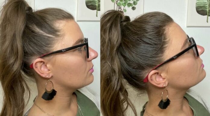 Quelle coiffure quand on a pas beaucoup de cheveux ? Quelle coiffure quand on a pas beaucoup de cheveux ?